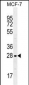 LGALS3 Antibody (C-term)